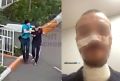 «Мне горло зашили, теперь есть, пить больно»: красноярец, на которого напал мужчина с ножом, рассказал о своем состоянии