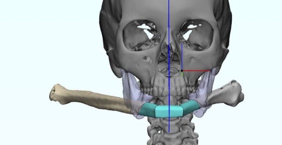   3D-:       