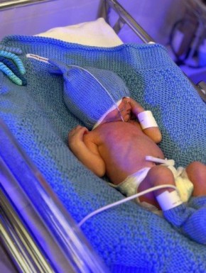 Самым маленьким ребёнком, родившимся в октябре, стал мальчик весом 800 граммов