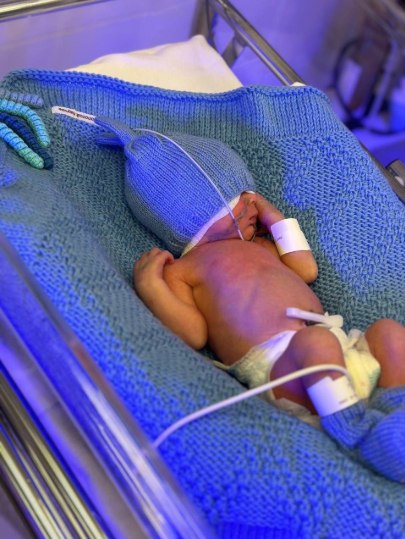 Самым маленьким ребёнком, родившимся в октябре, стал мальчик весом 800 граммов