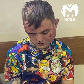 Это Спартак, который убил подростка в Шарыпово