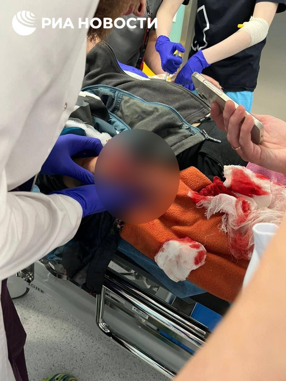 ЖЕСТКИЕ КАДРЫ! В Красногорске ребенок поднял с земли 10-рублевую купюру и ему разорвало кисть