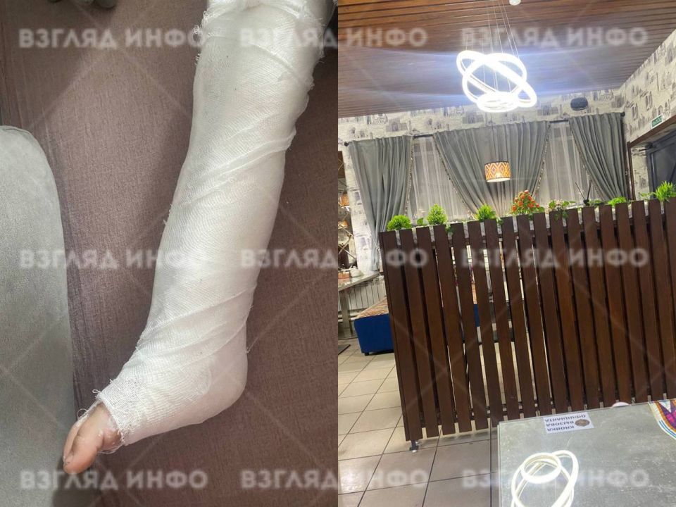 Двухлетнюю девочку придавило декором в минусинском кафе, с переломом ноги ребенка доставили в больницу