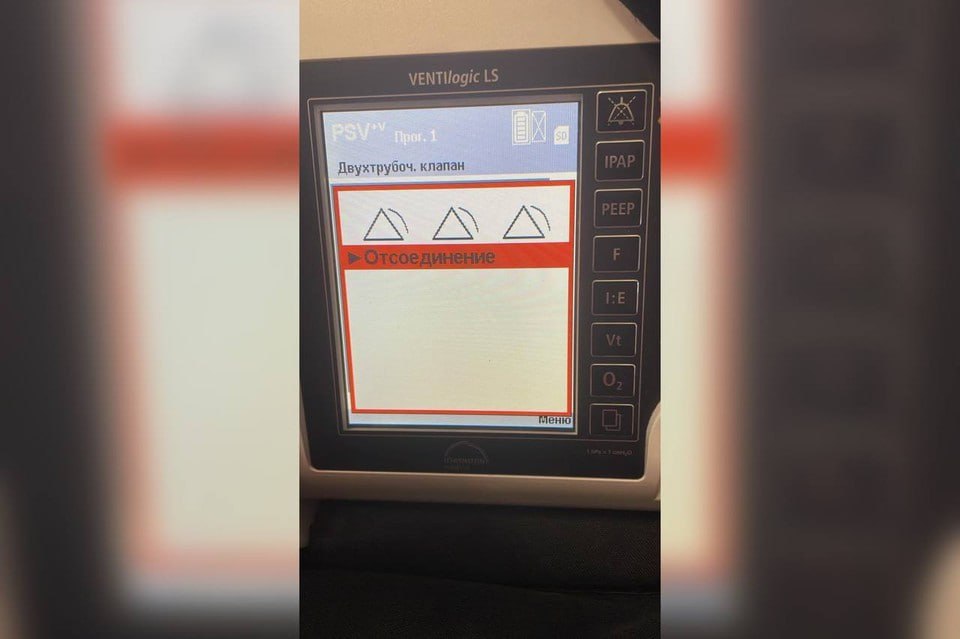 В Красноярске семилетней девочке-инвалиду полгода не меняли неисправный аппарат искусственной вентиляции легких