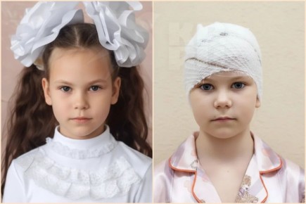 Пронзительное признание девочки, с которой пес сорвал скальп: «Когда меня кусала собака, я молилась!»