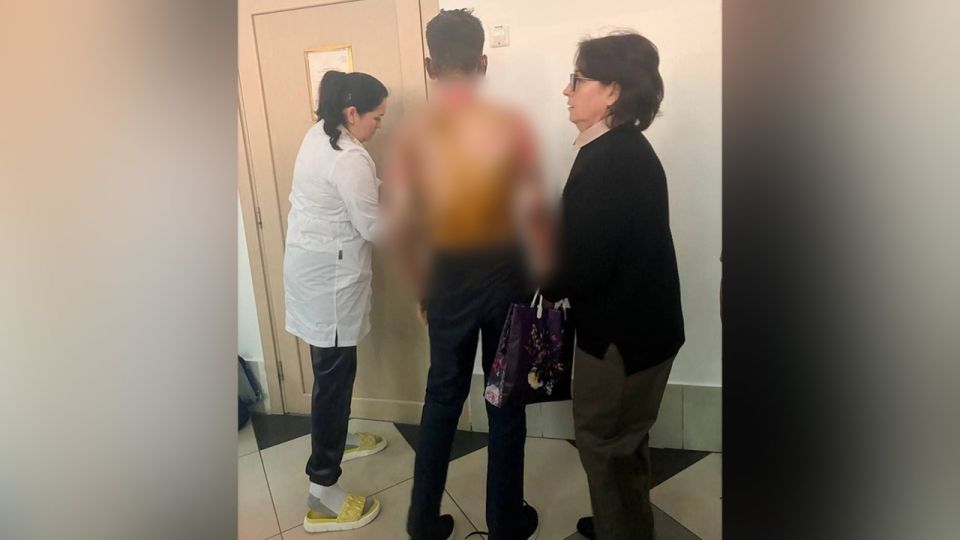 Трое детей с ожогами попали в больницу после ЧП в красноярской школе