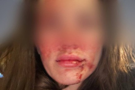 � ����������� 38-������� ��������� ������������ ����� ������ �� ��������������� ��������� �������