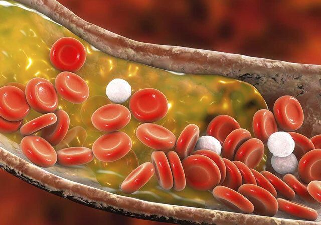 ������� ������� �����������: �������� ��������, ������� �������