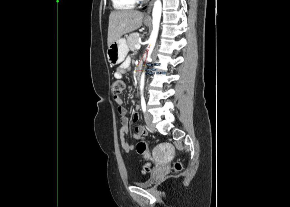 ��� ����� ��������� ���������: ������� �������������� ���������� � ������ ������������