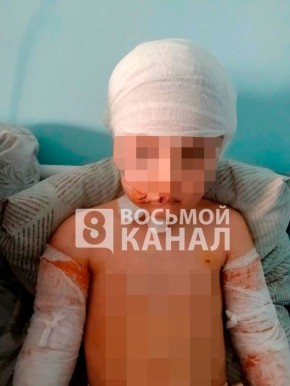 Председатель СКР Бастрыкин А.И. затребовал доклад о расследовании обстоятельств нападения собак на 5-летнюю девочку в Диксоне