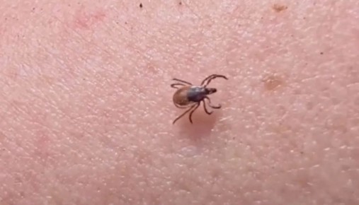 Первые случаи клещевого энцефалита зафиксировали в Красноярском крае