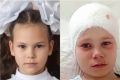 Кроха лежала на земле, как комочек: овчарка сняла скальп с девочки, но хозяйку зверя оставили на свободе