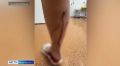 В Большой Мурте суд взыскал 60 тысяч рублей с хозяйки шести собак — животные покусали местную жительницу