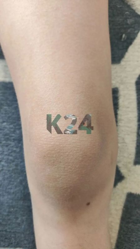 Красноярка утверждает, что её 7-летнюю дочь избивали в детском лагере Красноярка утверждает, что её 7-летнюю дочь избивали в детском лагере