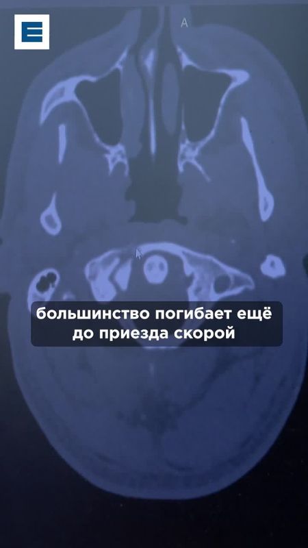 Красноярские врачи спасли мотогонщика со сломанным шейным позвонком