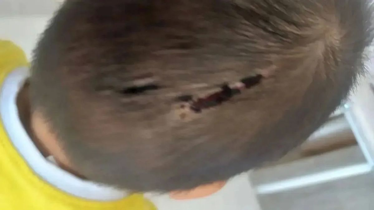 В Тыве избитого 4-летнего мальчика из многодетной семьи забрали органы опеки